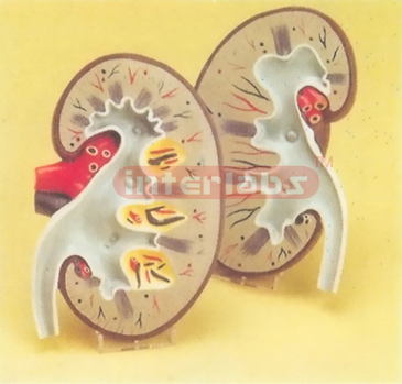 WEST TYPE MIDDLE ANATOMICAL KIDNEY MODEL WITHOUT BASE (2 PCS / SET)